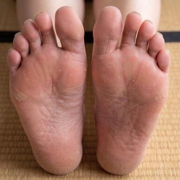 広告画像